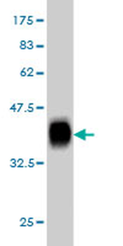 RHCG monoclonal antibody (M06), clone 5A4