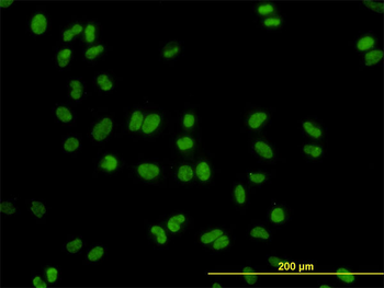 DDX41 monoclonal antibody (M01), clone 2F4