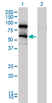DDX41 monoclonal antibody (M01), clone 2F4