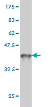 DDX41 monoclonal antibody (M01), clone 2F4