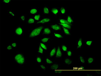 POLK monoclonal antibody (M01), clone 6F2
