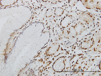POLK monoclonal antibody (M01), clone 6F2