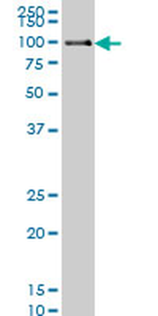 POLK monoclonal antibody (M01), clone 6F2