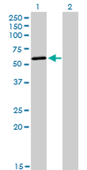 POLK monoclonal antibody (M01), clone 6F2