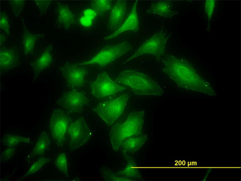 TRAPPC4 monoclonal antibody (M01), clone 2D10