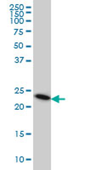 TRAPPC4 monoclonal antibody (M01), clone 2D10