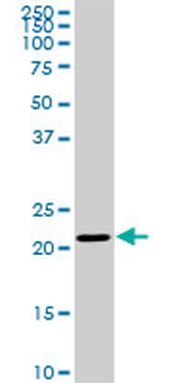 TRAPPC4 monoclonal antibody (M01), clone 2D10