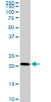 TRAPPC4 monoclonal antibody (M01), clone 2D10