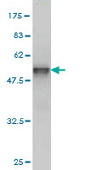 TRAPPC4 monoclonal antibody (M01), clone 2D10