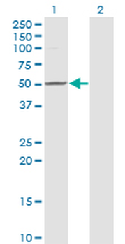 ZMYND10 monoclonal antibody (M24), clone 3D11