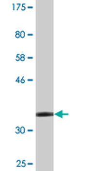 ZMYND10 monoclonal antibody (M24), clone 3D11