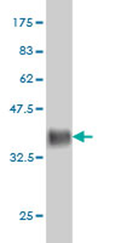 ARL6IP4 monoclonal antibody (M09), clone 5E5