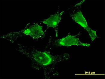 GOLM1 monoclonal antibody (M06), clone 5B10