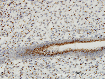 GOLM1 monoclonal antibody (M06), clone 5B10