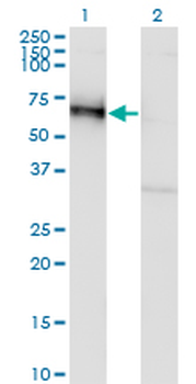 GOLM1 monoclonal antibody (M06), clone 5B10