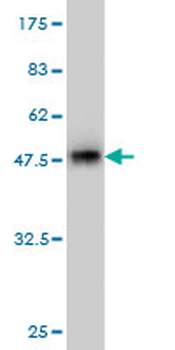 GOLM1 monoclonal antibody (M06), clone 5B10