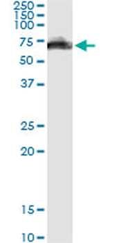 GOLM1 monoclonal antibody (M04), clone 3B10
