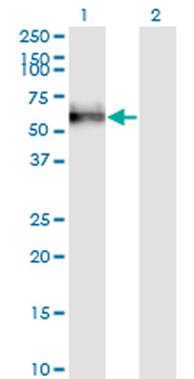 GOLM1 monoclonal antibody (M04), clone 3B10