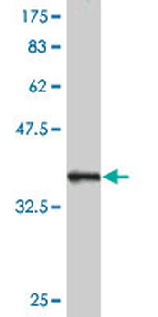GOLM1 monoclonal antibody (M04), clone 3B10