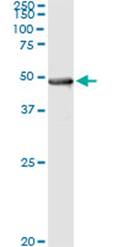 PIPOX monoclonal antibody (M10), clone 3D1