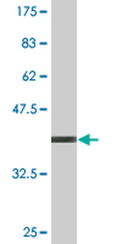 PIPOX monoclonal antibody (M10), clone 3D1