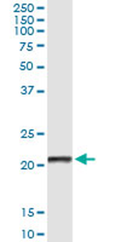 CLEC1B monoclonal antibody (M02), clone 1C10