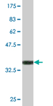 CLEC1B monoclonal antibody (M02), clone 1C10