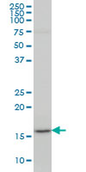 LEF1 monoclonal antibody (M01), clone 3H5