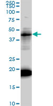 LEF1 monoclonal antibody (M01), clone 3H5