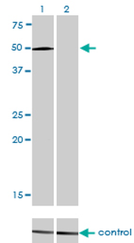 LEF1 monoclonal antibody (M01), clone 3H5