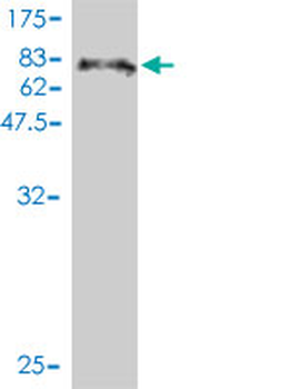 LEF1 monoclonal antibody (M01), clone 3H5