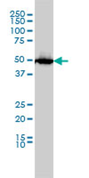 SLC45A2 monoclonal antibody (M01), clone 2F4