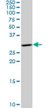 HSD17B12 polyclonal antibody (A01)