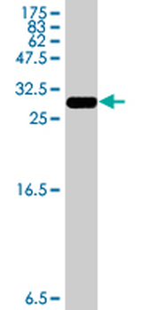 HSD17B12 polyclonal antibody (A01)