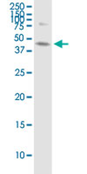 ABHD5 monoclonal antibody (M01), clone 1F3