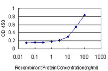 ABHD5 monoclonal antibody (M01), clone 1F3