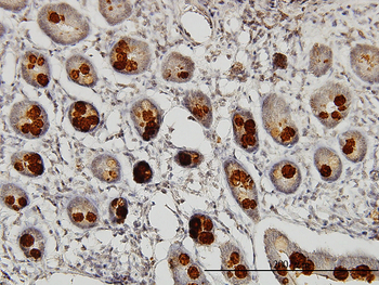 ABHD5 monoclonal antibody (M01), clone 1F3