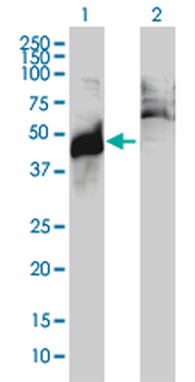 ABHD5 monoclonal antibody (M01), clone 1F3