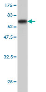 ABHD5 monoclonal antibody (M01), clone 1F3