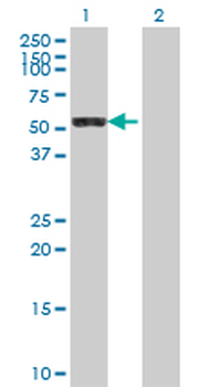LAP3 polyclonal antibody (A01)