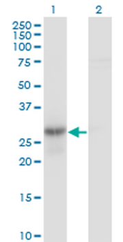 GMNN monoclonal antibody (M01), clone 1A8