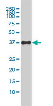 F11R monoclonal antibody (M01), clone 2E3-1C8