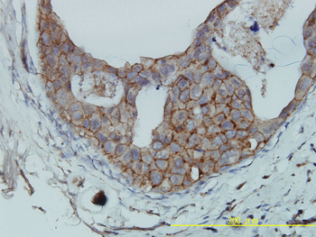 F11R monoclonal antibody (M01), clone 2E3-1C8