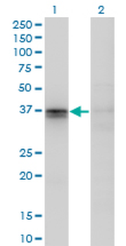 F11R monoclonal antibody (M01), clone 2E3-1C8