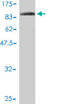 F11R monoclonal antibody (M01), clone 2E3-1C8