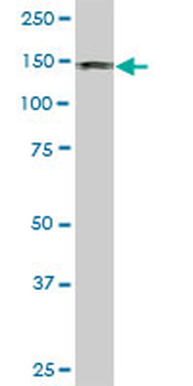 DDEF1 monoclonal antibody (M01), clone 2G7