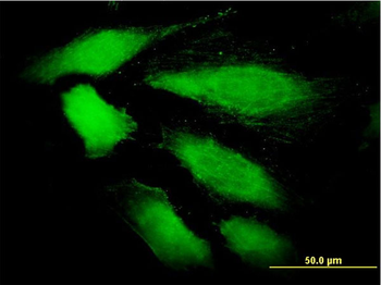 DDEF1 monoclonal antibody (M01), clone 2G7