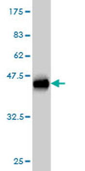 DDEF1 monoclonal antibody (M01), clone 2G7