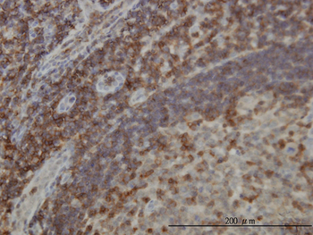 DEF6 monoclonal antibody (M01), clone 1F2