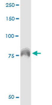 DEF6 monoclonal antibody (M01), clone 1F2